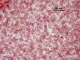 3 - Cellule corticali pigmentate ed utricoli in visione superficiale